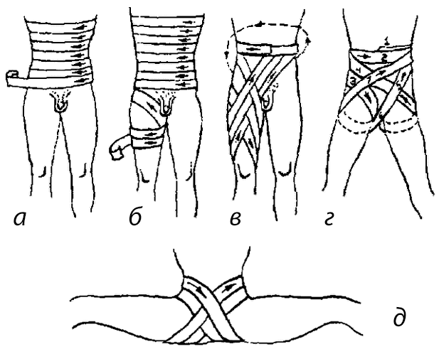 Повязки при повреждении живота и таза