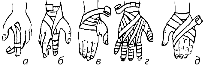 Повязки при повреждении пальцев и кисти