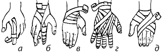 Повязки при повреждении пальцев и кисти